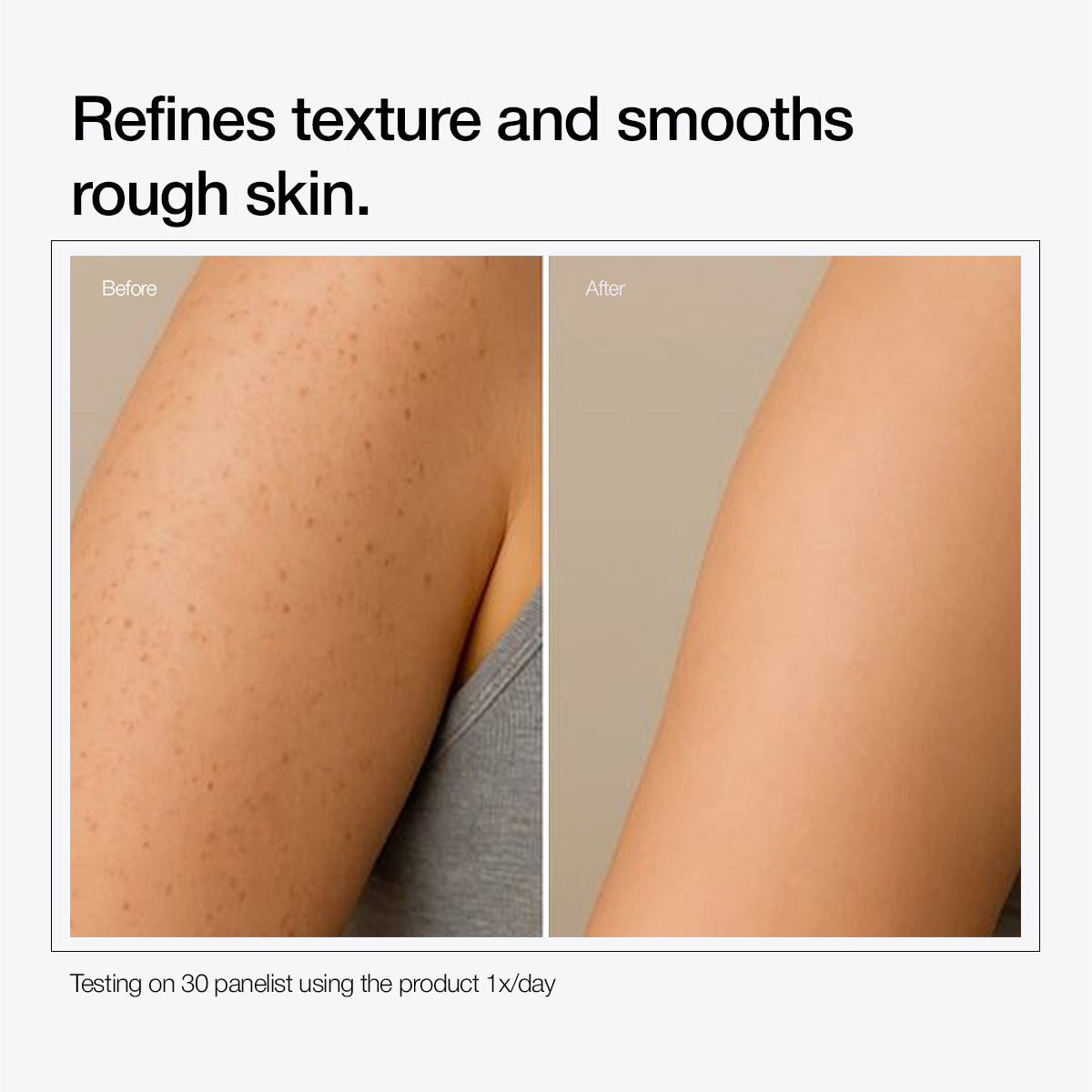 Urea 10% Pre Bath Gel