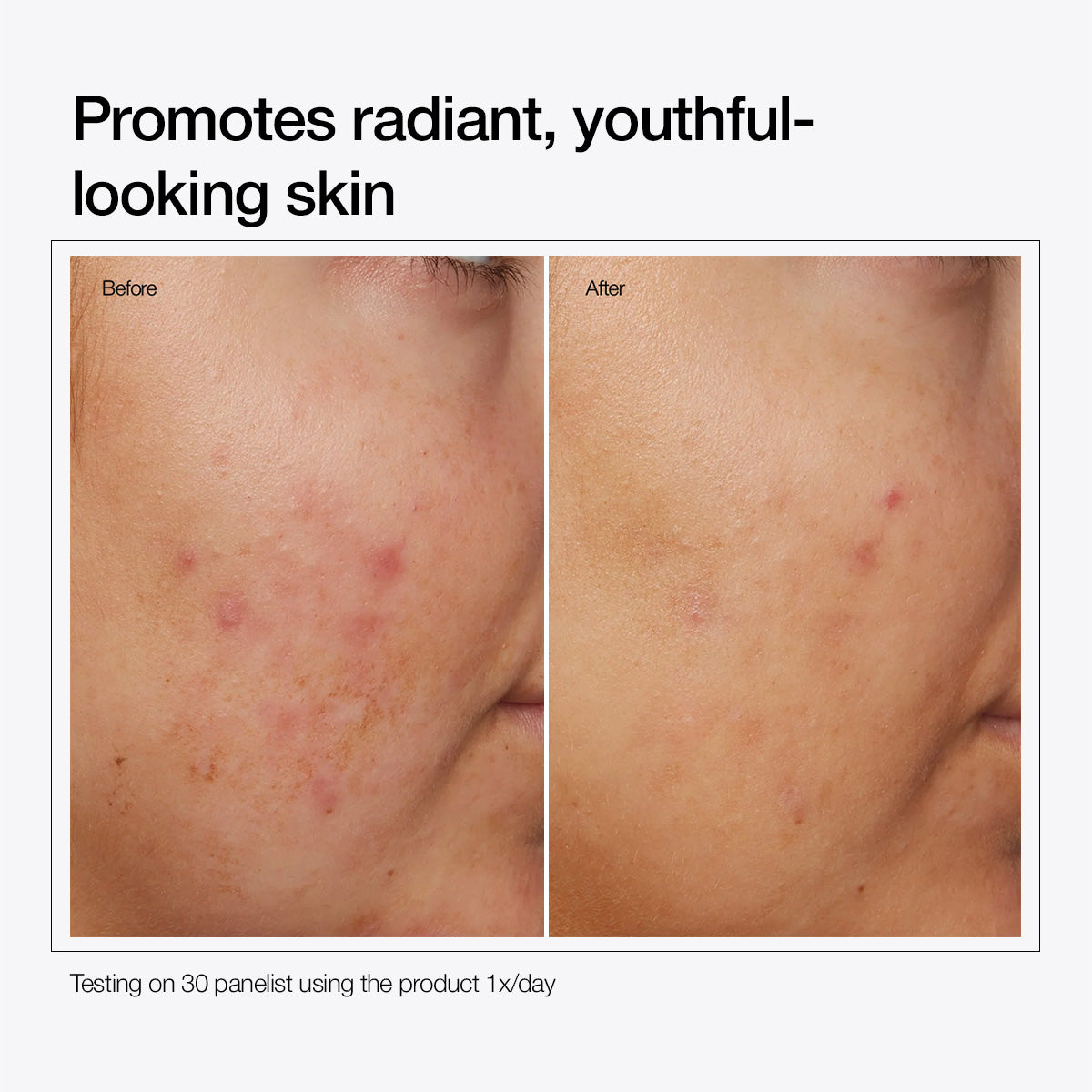 Niacinamide 10% + Zinc 1%