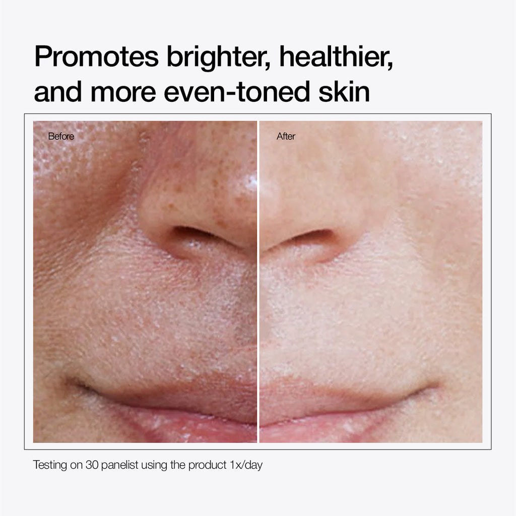 Magnesium Ascorbyl Phosphate 10%