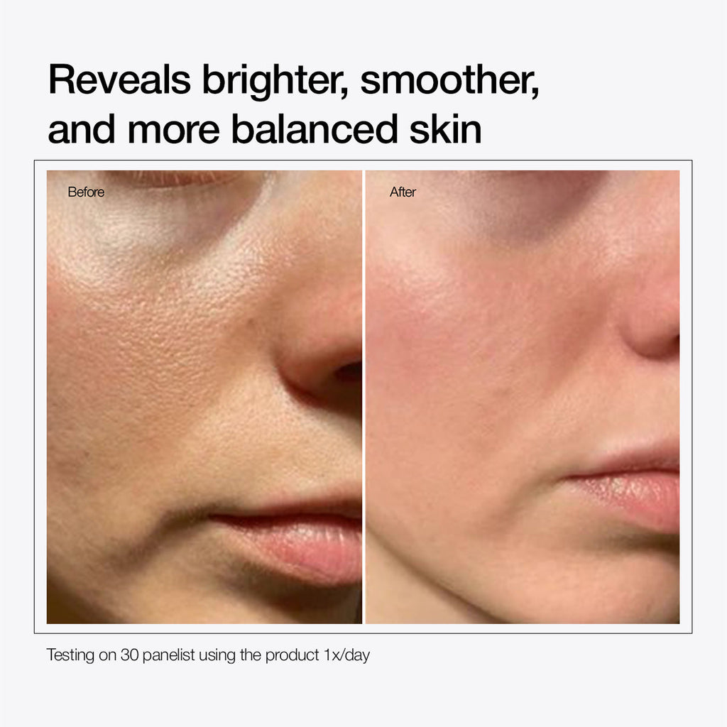 Alpha Arbutin 2% + Licorice Extract