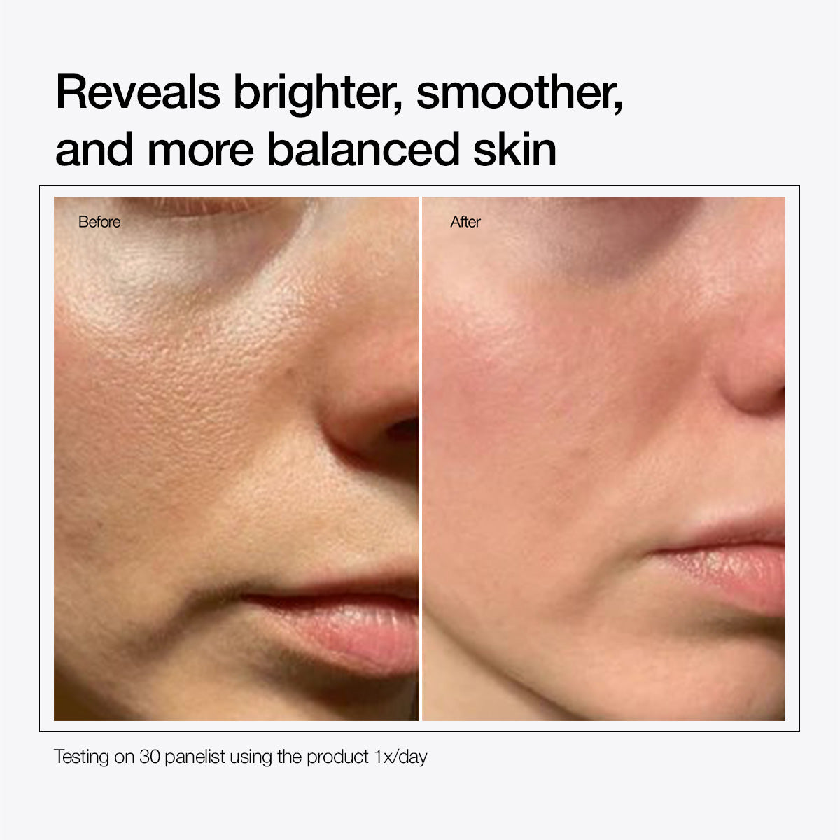 Alpha Arbutin 2% + Licorice Extract